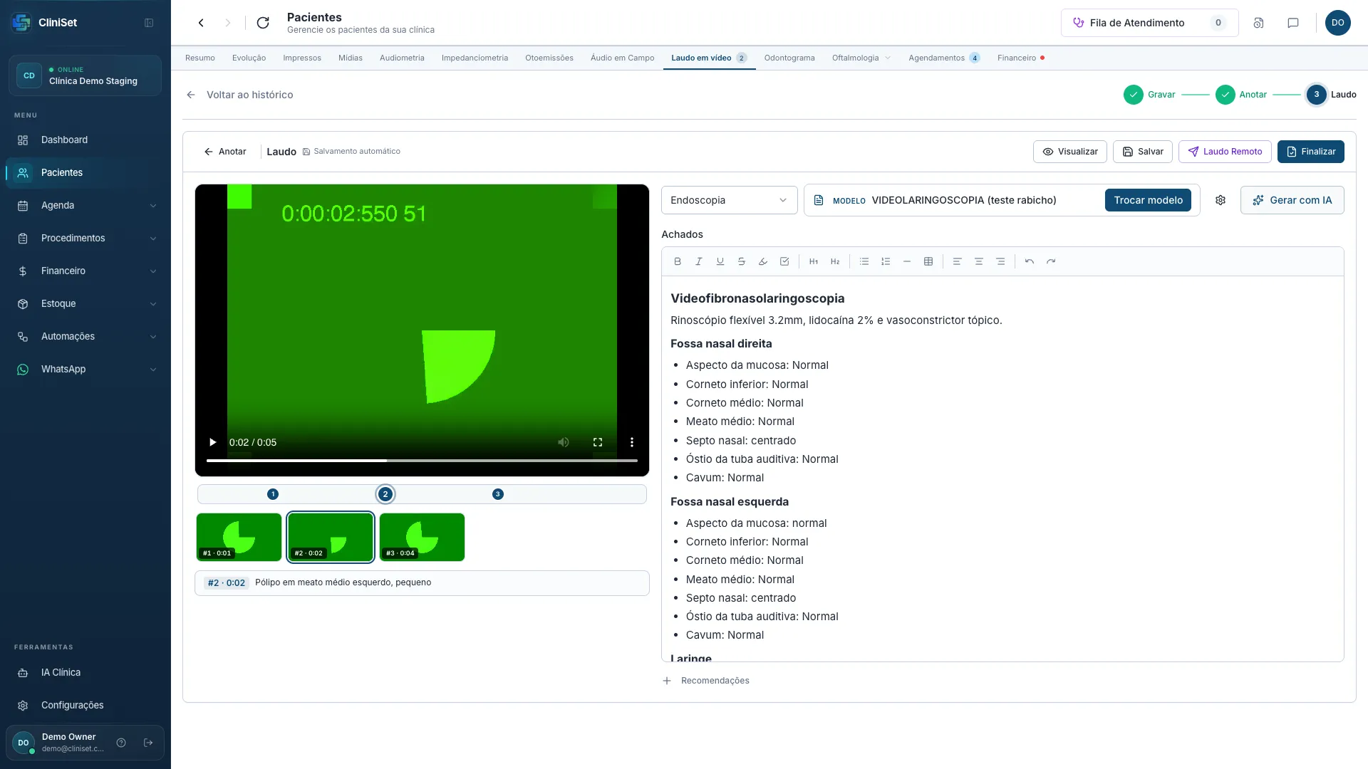 Passo Laudo com o vídeo à esquerda e o texto à direita